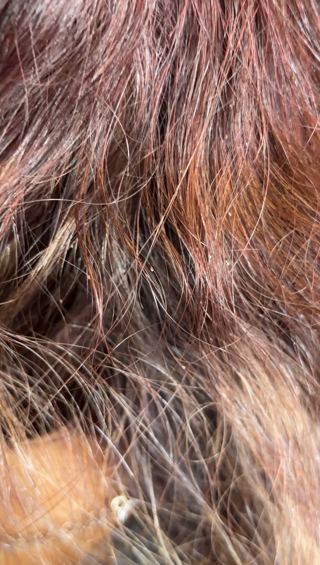 What Do Lice Eggs ( Nits ) Look Like? How to Tell the Difference from Dandruff.