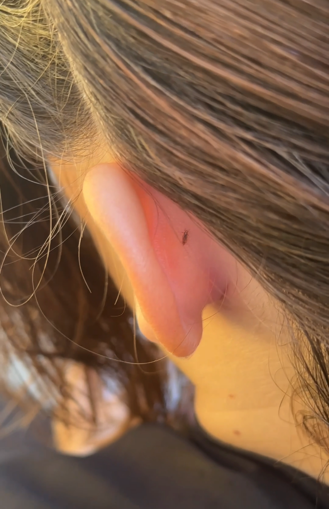 Best Way to Treat Head Lice | Natural Lice Removal in Atlanta, GA