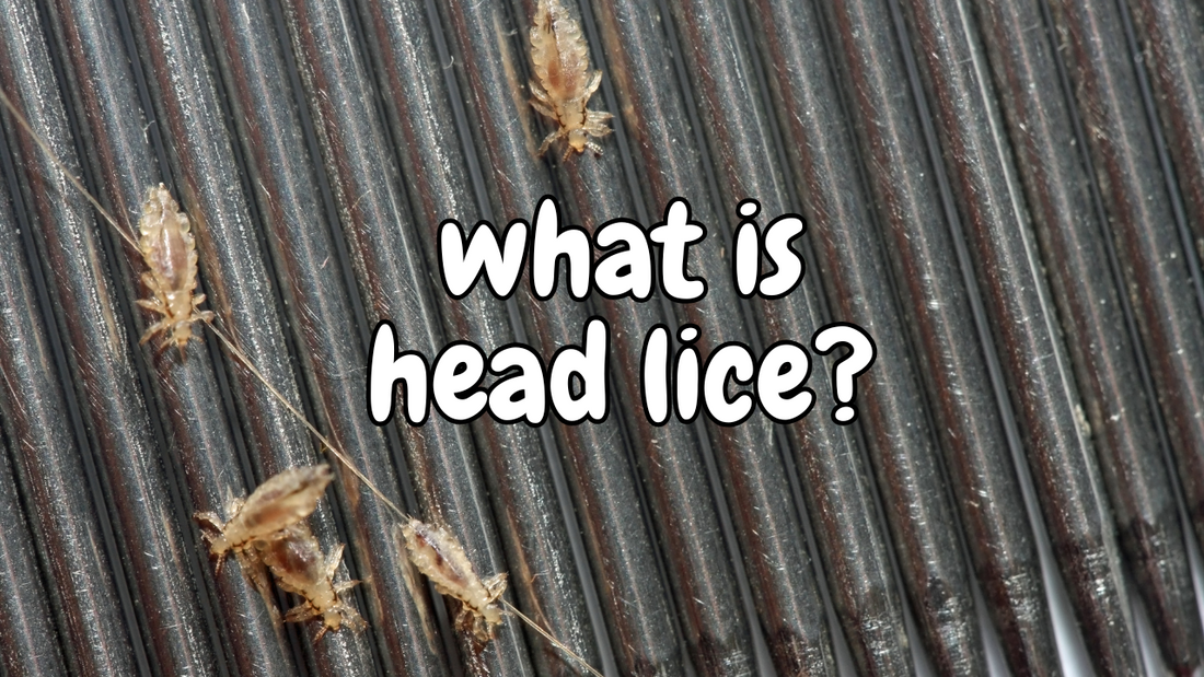 What Are Head Lice? | Atlanta Lice Removal Expert