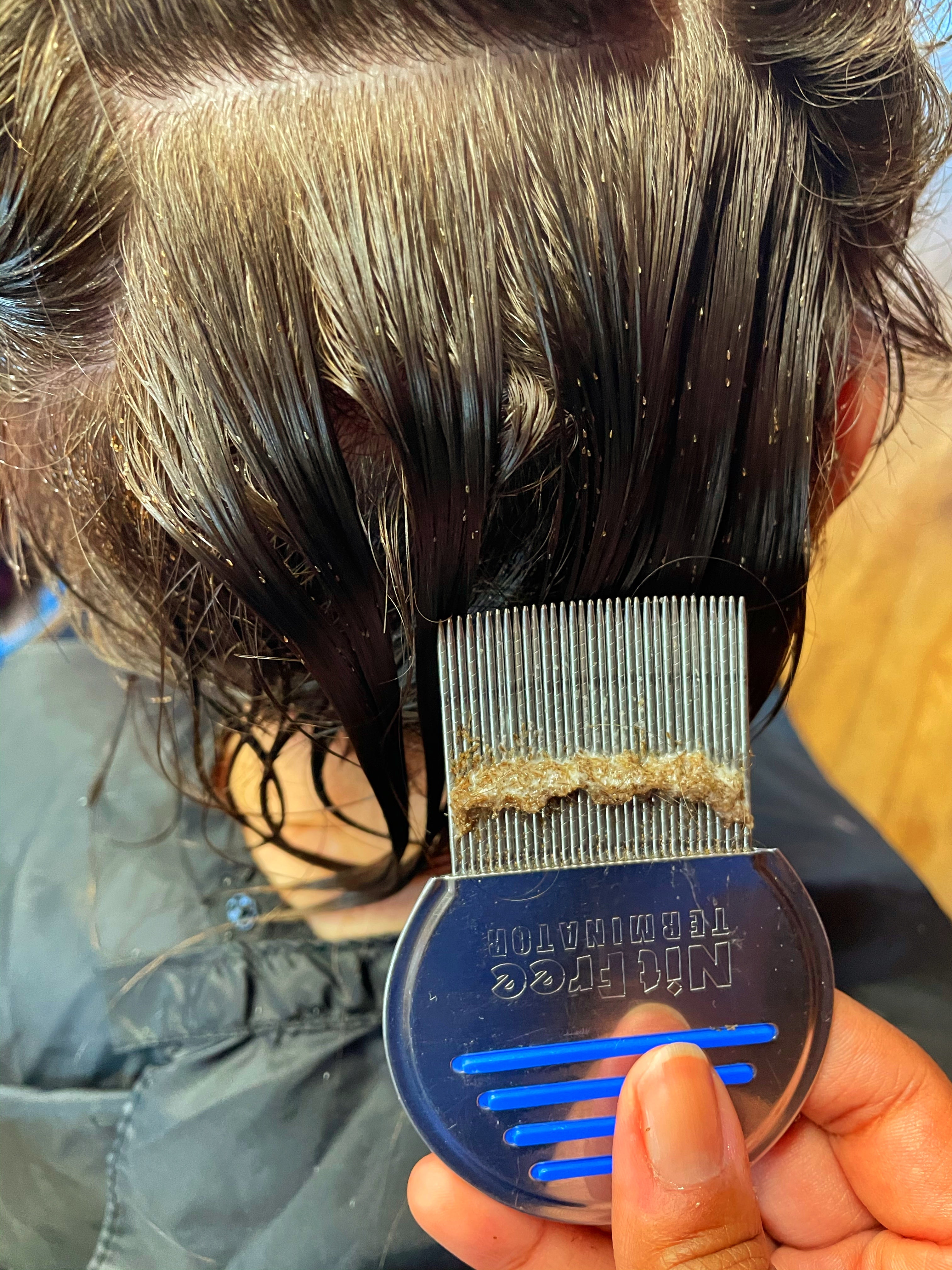 <transcy>Peine para piojos Terminator</transcy>
