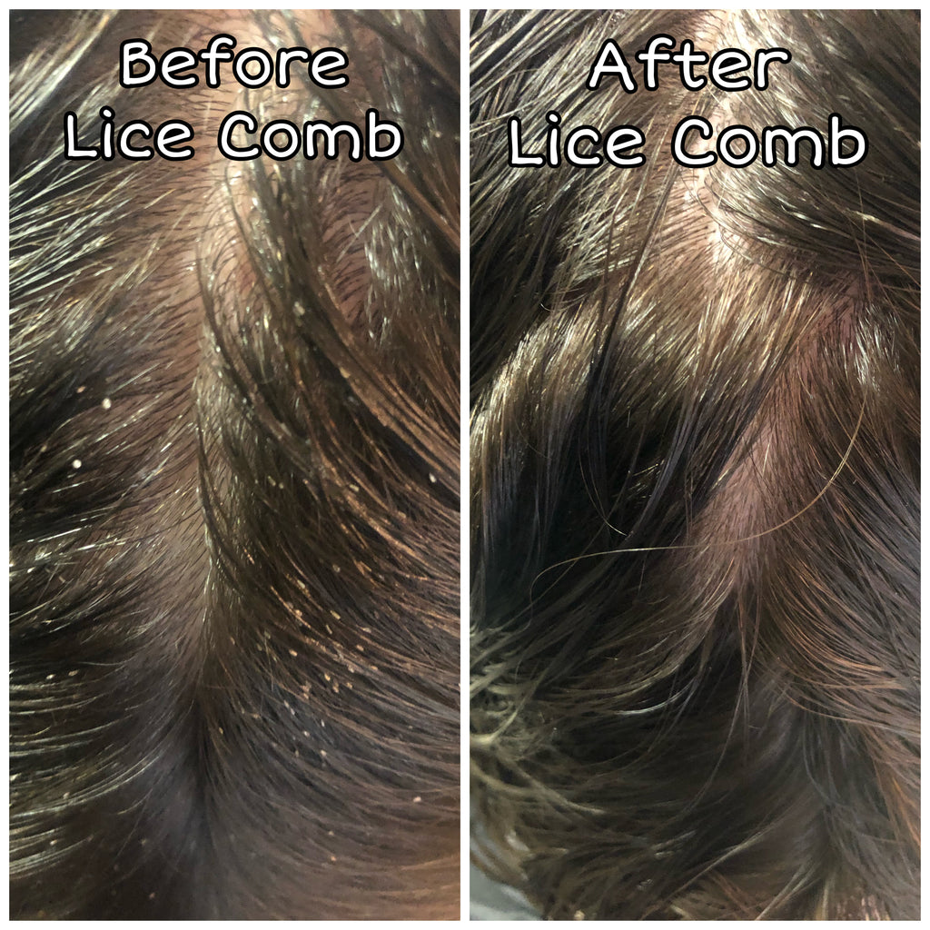 <transcy>Peine para piojos Terminator</transcy>